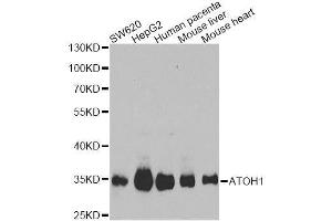 Western blot analysis of extracts of various cell lines, using ATOH1 Antibody. (ATOH1 Antikörper  (AA 215-354))