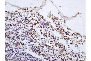 Formalin-fixed and paraffin embedded mouse spleen labeled with Rabbit Anti-IRAK1 (Thr387) Polyclonal Antibody, Unconjugated  at 1:200 followed by conjugation to the secondary antibody and DAB staining (IRAK1 Antikörper  (pThr387))