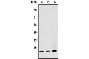 Western blot analysis of ATP5G1 expression in HEK293T (A), Raw264. (ATP5G1 Antikörper  (Center))