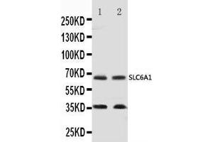 Anti-GABA Transporter 1/GAT 1 antibody, Western blotting Lane 1: Rat Brain Tissue Lysate Lane 2: Mouse Brain Tissue Lysate (SLC6A1 Antikörper  (C-Term))