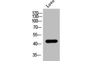 Western Blot analysis of Lovo cells using Phospho-MOR-1 (S375) Polyclonal Antibody (Mu Opioid Receptor 1 Antikörper  (pSer375))