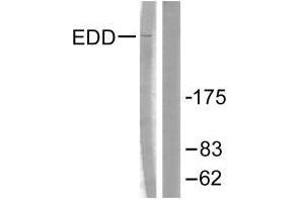 Western blot analysis of extracts from A549 cells, using EDD antibody. (UBR5 Antikörper)