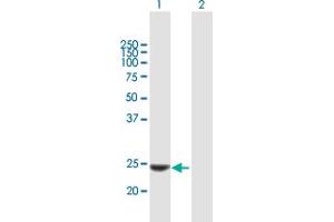 Western Blot analysis of KLK14 expression in transfected 293T cell line by KLK14 MaxPab polyclonal antibody. (Kallikrein 14 Antikörper  (AA 1-251))