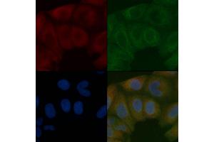 Mitofusin 2 Mouse Monoclonal Antibody staining Hela cells by IF/ICC.