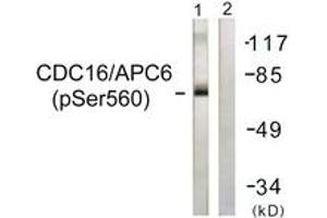 Western blot analysis of extracts from HuvEc cells, using CDC16/APC6 (Phospho-Ser560) Antibody. (CDC16 Antikörper  (pSer560))