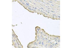 Immunohistochemistry of paraffin-embedded human prostate using FABP12 antibody. (FABP12 Antikörper)