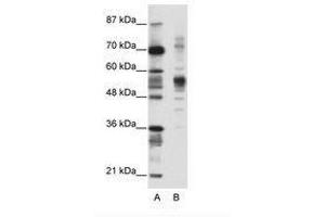 Image no. 1 for anti-Coronin, Actin Binding Protein, 1A (CORO1A) (C-Term) antibody (ABIN202576) (Coronin 1a Antikörper  (C-Term))