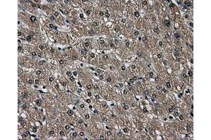 Immunohistochemical staining of paraffin-embedded liver tissue using anti-AKR1A1mouse monoclonal antibody. (AKR1A1 Antikörper)