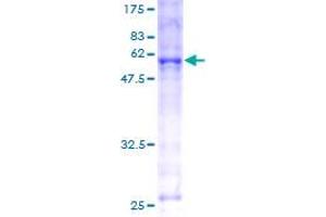 Image no. 1 for Heme Oxygenase (Decycling) 1 (HMOX1) (AA 1-288) protein (GST tag) (ABIN1306835)