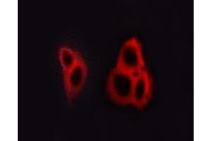 ABIN6267615 staining A549 cells by ICC/IF. (GRIN1/NMDAR1 Antikörper  (pSer890))