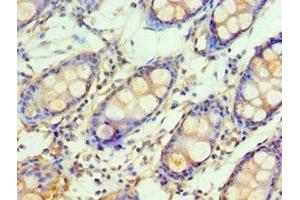 Immunohistochemistry of paraffin-embedded human colon tissue using ABIN7154111 at dilution of 1:100 (GSTM4 Antikörper  (AA 1-218))