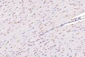 Immunohistochemistry (Paraffin-embedded Sections) (IHC (p)) image for anti-Nucleoporin 133kDa (NUP133) antibody (ABIN7074909)