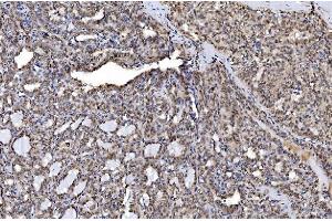 IHC analysis of Aurora A/AURKA using anti-Aurora A/AURKA antibody (ABIN7599581).
