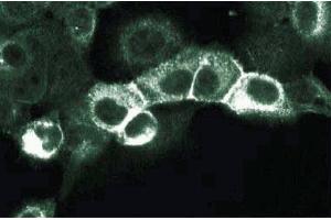 Immunofluorescence staining of A431 cells (Human epithelial carcinoma, ATCC CRL-1555). (ErbB2/Her2 Antikörper  (AA 182-373))