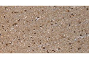 Immunohistochemistry of paraffin-embedded Human brain tissue using NLRP6 Polyclonal Antibody at dilution 1:50 (NLRP6 Antikörper)