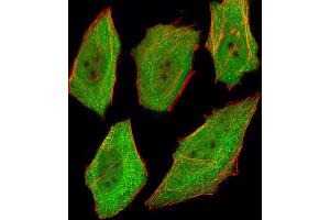 Immunofluorescence (IF) image for anti-Valosin Containing Protein (VCP) (AA 1-225) antibody (ABIN1944899)