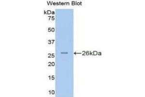 Western Blotting (WB) image for anti-Protein Kinase N2 (PKN2) (AA 282-487) antibody (ABIN1175312) (PKN2 Antikörper  (AA 282-487))
