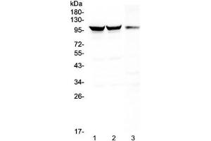 Western blot testing of 1) rat brain, 2) mouse brain and 3) mouse NIH3T3 lysate with Dynamin 1 antibody at 0. (Dynamin 1 Antikörper)