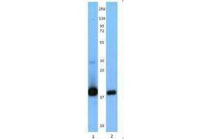 Western Blotting (WB) image for anti-Interleukin 21 (IL21) antibody (ABIN2666226) (IL-21 Antikörper)