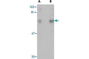 Western blot analysis of CPEB1 in rat brain tissue lysate with CPEB1 polyclonal antibody  at (A) 1 and (B) 2 ug/mL .
