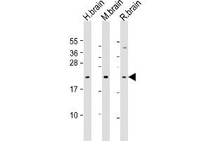 All lanes : Anti-FGF12 Antibody (Center) at 1:1000 dilution Lane 1: human brain lysate Lane 2: mouse brain lysate Lane 3: rat brain lysate Lysates/proteins at 20 μg per lane. (FGF12 Antikörper  (AA 159-191))