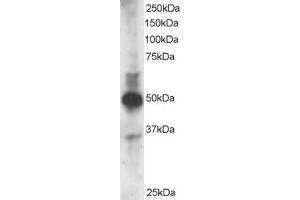 Western Blotting (WB) image for anti-GATA Binding Protein 3 (GATA3) (N-Term) antibody (ABIN2465221) (GATA3 Antikörper  (N-Term))