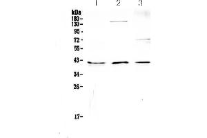 Western blot analysis of CD47 using anti-CD47 antibody . (CD47 Antikörper)