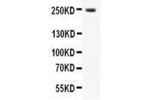 Western Blotting (WB) image for anti-Calcium Channel, Voltage-Dependent, L Type, alpha 1D Subunit (CACNA1D) (AA 2146-2161), (C-Term) antibody (ABIN3042544)