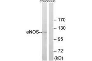 Western blot analysis of extracts from COLO cells, using eNOS (Ab-494) Antibody. (ENOS Antikörper  (AA 462-511))