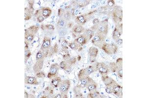Immunohistochemistry of paraffin-embedded human liver using BAAT Rabbit pAb (ABIN6131367, ABIN6137411, ABIN6137412 and ABIN6223563) at dilution of 1:500 (40x lens). (BAAT Antikörper  (AA 309-418))
