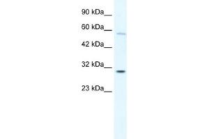 WB Suggested Anti-GATAD1 Antibody Titration: 0. (GATAD1 Antikörper  (C-Term))