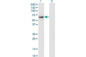 Western Blot analysis of ZNF350 expression in transfected 293T cell line by ZNF350 monoclonal antibody (M01), clone 1A9. (ZNF350 Antikörper  (AA 1-532))