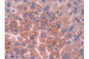 Immunohistochemistry (IHC) image for anti-Uncoupling Protein 2 (Mitochondrial, Proton Carrier) (UCP2) (AA 150-304) antibody (ABIN1175761)