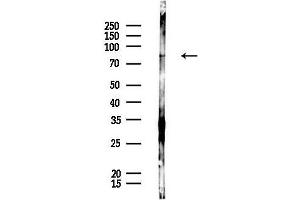 anti-Phosphofructokinase, Liver (PFKL) (C-Term) antibody