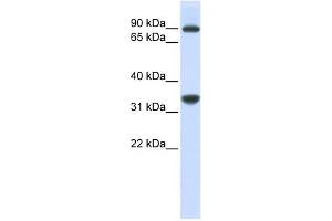 RRP1B antibody used at 1 ug/ml to detect target protein. (RRP1B Antikörper)