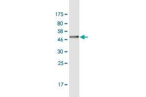 Western Blot detection against Immunogen (37. (ASH1L Antikörper  (AA 2859-2967))