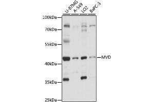 Western blot analysis of extracts of various cell lines, using MVD antibody (ABIN7268505) at 1:1000 dilution. (MVD Antikörper  (AA 1-270))