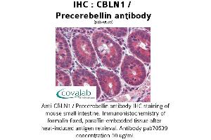 Image no. 2 for anti-Cerebellin 1 Precursor (CBLN1) antibody (ABIN1732717) (CBLN1 Antikörper)