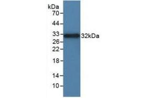 Western blot analysis of recombinant Rat ITGaD. (ITGAD Antikörper  (AA 879-1099))