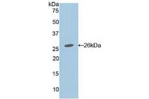 Western blot analysis of recombinant Mouse APC. (APC Antikörper  (AA 2636-2845))