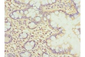 Immunohistochemistry of paraffin-embedded human small intestine tissue using ABIN7147935 at dilution of 1:100 (CLASP1 Antikörper  (AA 1389-1538))