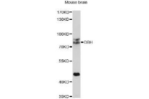 Western blot analysis of extracts of mouse brain, using DBH antibody (ABIN1872202) at 1:1000 dilution. (DBH Antikörper)