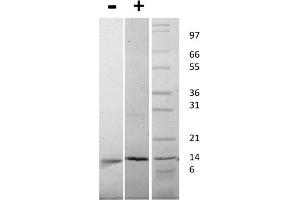SDS-PAGE (SDS) image for Nerve Growth Factor beta (NGFB) protein (ABIN6700296)