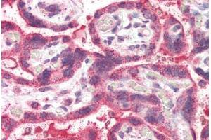 Human Placenta (formalin-fixed, paraffin-embedded) stained with NEIL1 antibody ABIN337008 at 5 ug/ml followed by biotinylated anti-goat IgG secondary antibody ABIN481715, alkaline phosphatase-streptavidin and chromogen. (NEIL1 Antikörper  (AA 378-390))