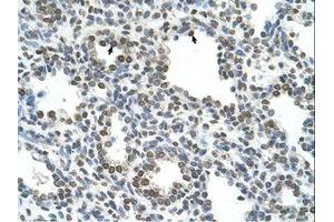 Image no. 1 for anti-Naked Cuticle Homolog 1 (NKD1) (AA 65-114) antibody (ABIN6739155) (NKD1 Antikörper  (AA 65-114))