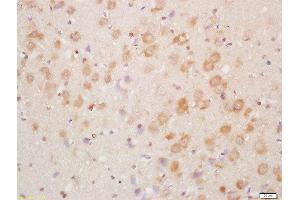 Formalin-fixed and paraffin embedded mouse brain labeled with Rabbit Anti-NDUFA8 Polyclonal Antibody, Unconjugated  at 1:200 followed by conjugation to the secondary antibody and DAB staining (NDUFA8 Antikörper  (AA 101-172))