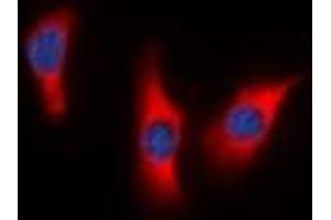 Immunofluorescent analysis of DUSP9 staining in HeLa cells. (DUSP9 Antikörper)