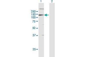 Western Blot analysis of LLGL2 expression in transfected 293T cell line by LLGL2 MaxPab polyclonal antibody. (LLGL2 Antikörper  (AA 1-1020))