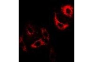 Immunofluorescent analysis of H-FABP staining in U2OS cells. (FABP3 Antikörper)