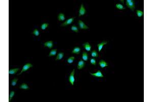 Immunofluorescence analysis of A549 cell using HELLS antibody. (HELLS Antikörper)